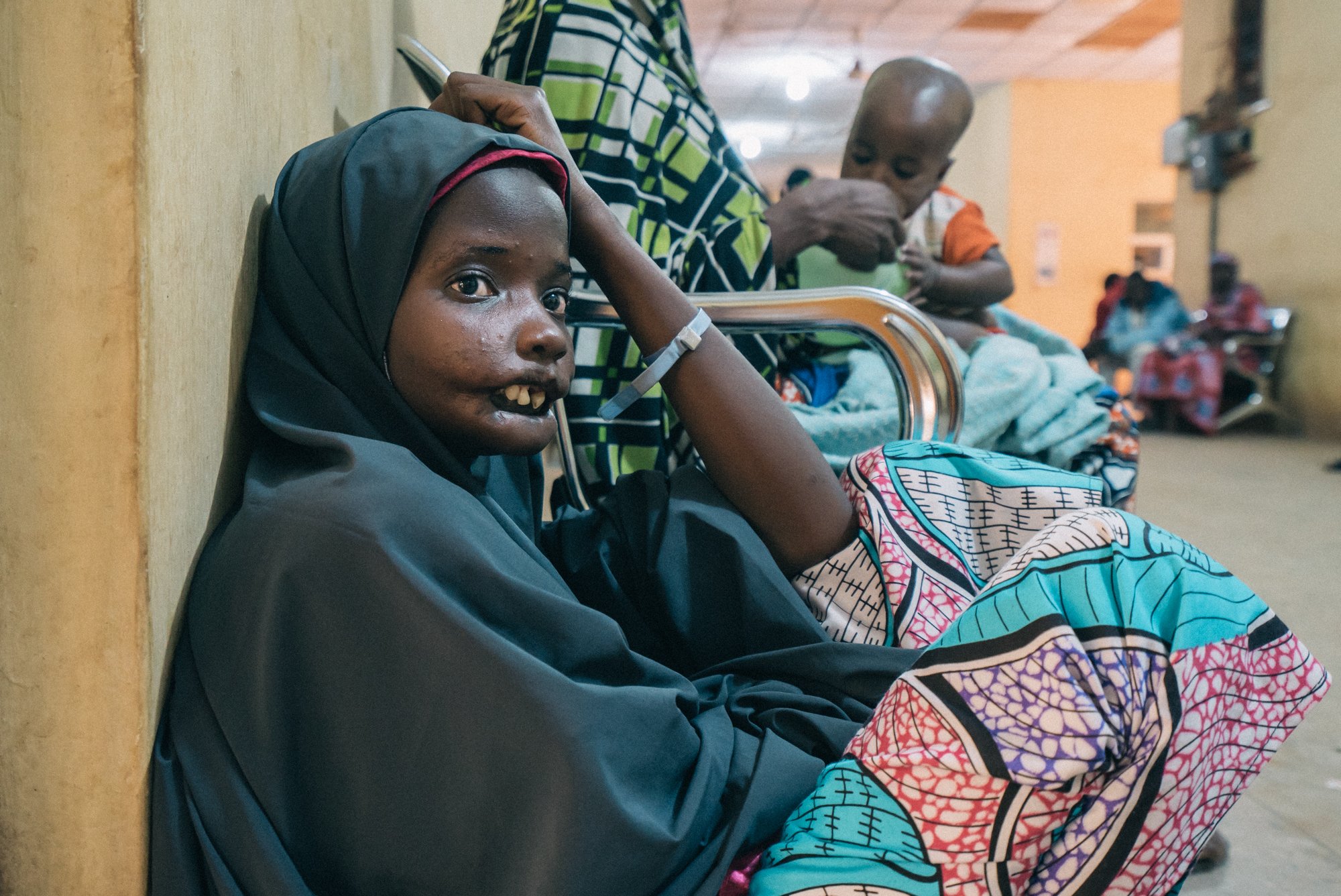 Amina, a 19-year-old noma patient from Yobe state, waits for the screening session at Noma Hospital in Sokoto. Amina came several times since her first visit in November 2016. Nigeria, on October 2017.